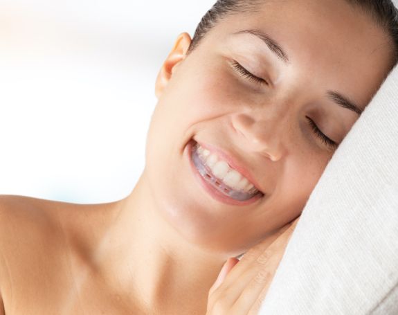 Woman sleeping with clear nightguard for bruxism in place